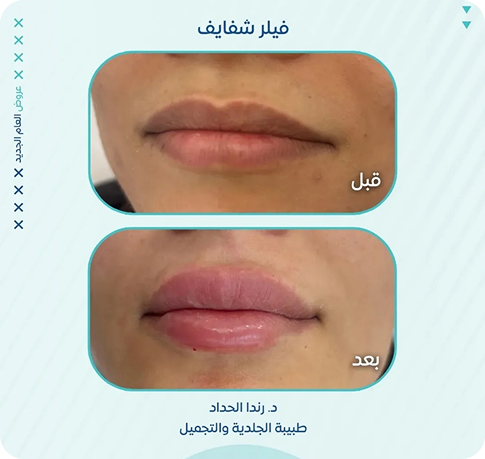 About-Us (6)